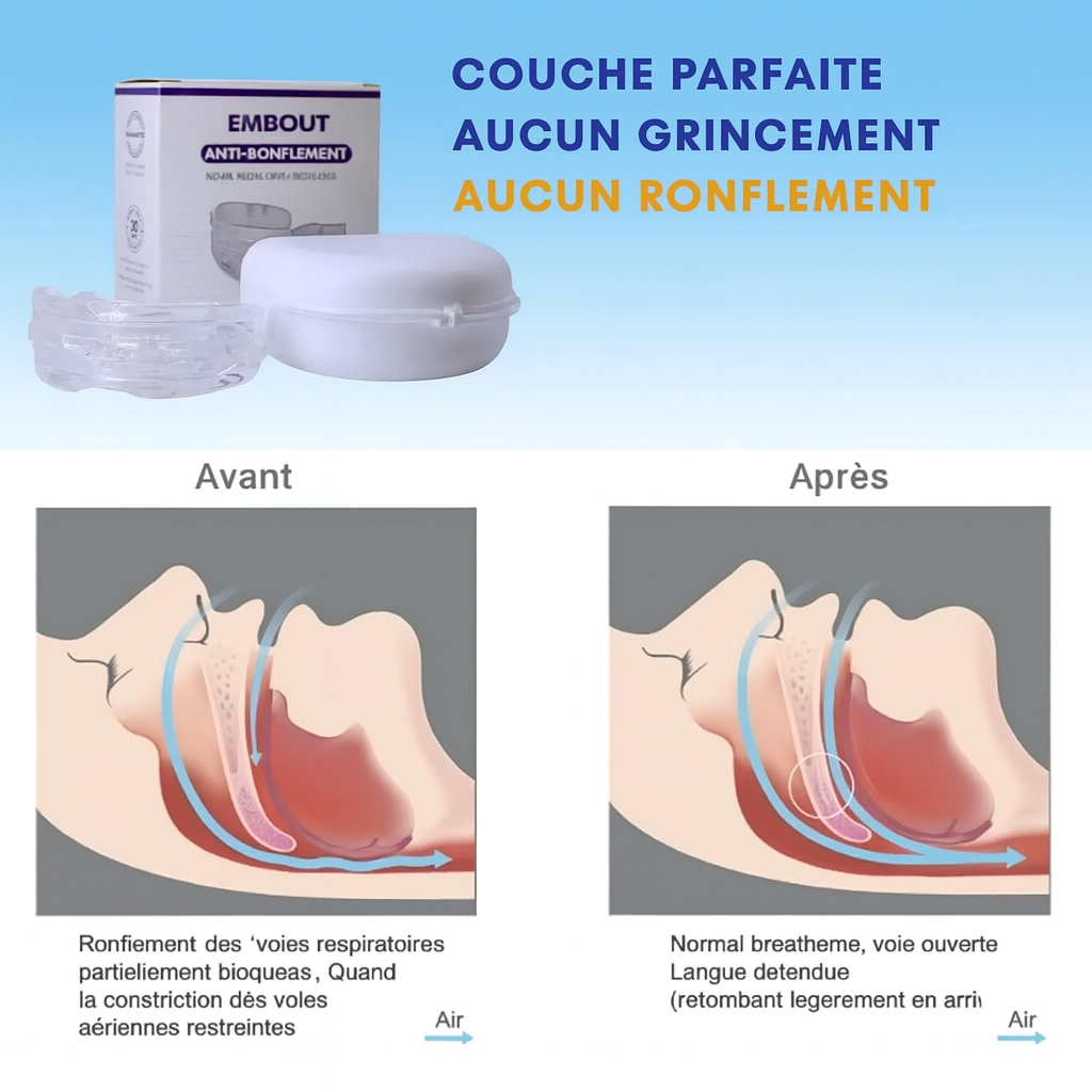 Gouttière anti-ronflement