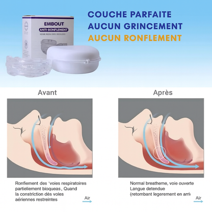Gouttière anti-ronflement